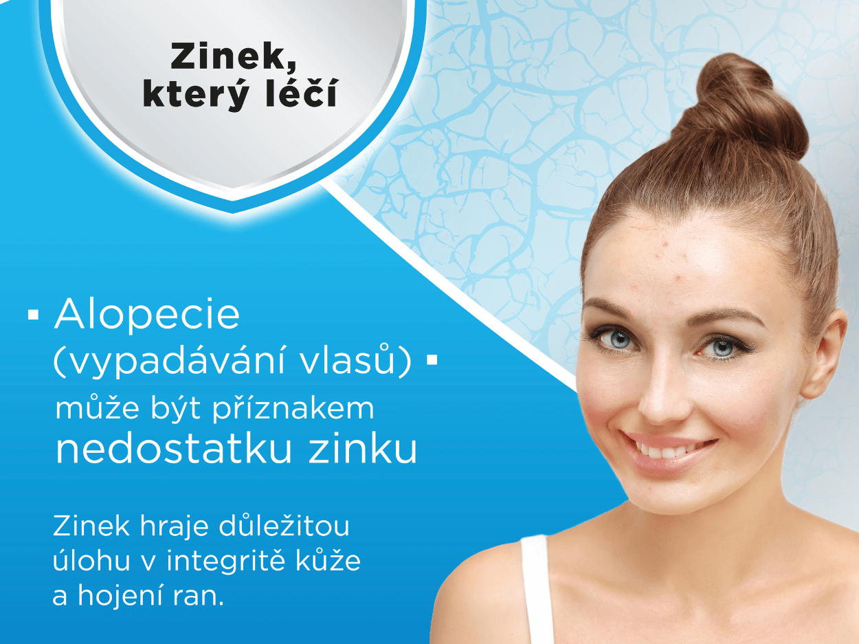 Alopecie